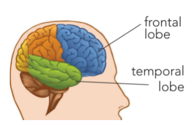 Image of a brain with lobes highlighted